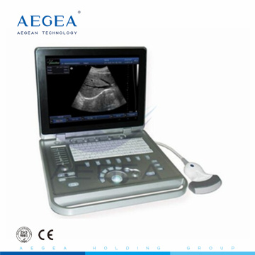 AG-BU009 tragbarer Diagnosegerät klinische Ultraschallgerätehersteller